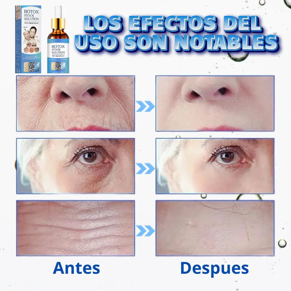 Suero Botox® | Recibe GRATIS crema SkinRepair 🎁