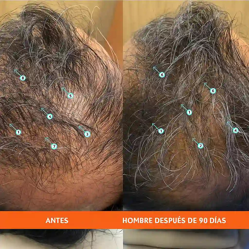 Revita® | Tu cabello merece volver a ser tu orgullo