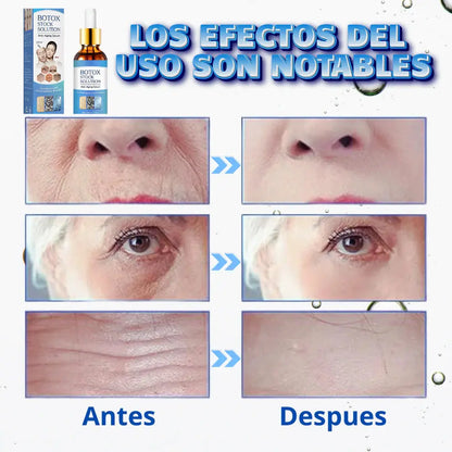 Suero Botox® | Recibe GRATIS crema SkinRepair 🎁