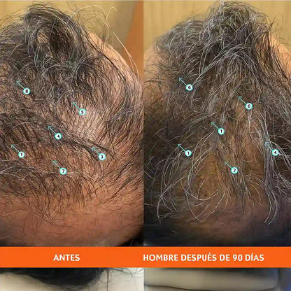 Revita® | Tu cabello merece volver a ser tu orgullo
