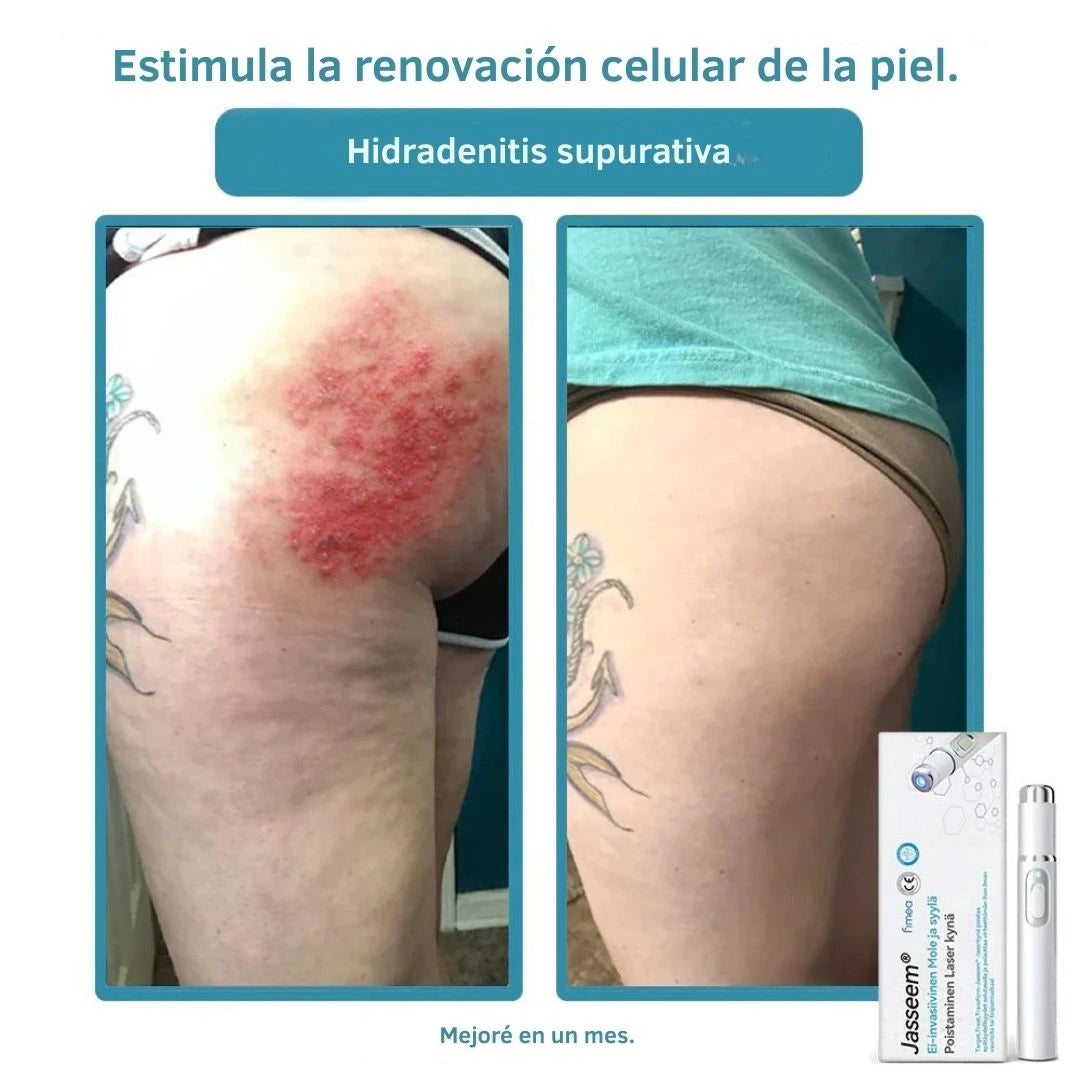 Slov Beauty – Tu piel radiante y natural en solo semanas