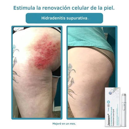 Slov Beauty – Tu piel radiante y natural en solo semanas